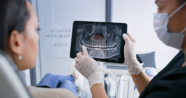 Licensed Root Canal Treatment service in Forsyth, MT - Smile Center Dentistry