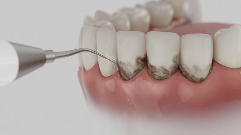 Reliable Root Canal Treatment contractor in Forsyth, MT by Smile Center Dentistry